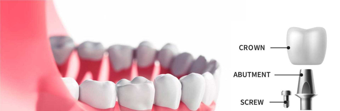 Tcare dental Cover Image