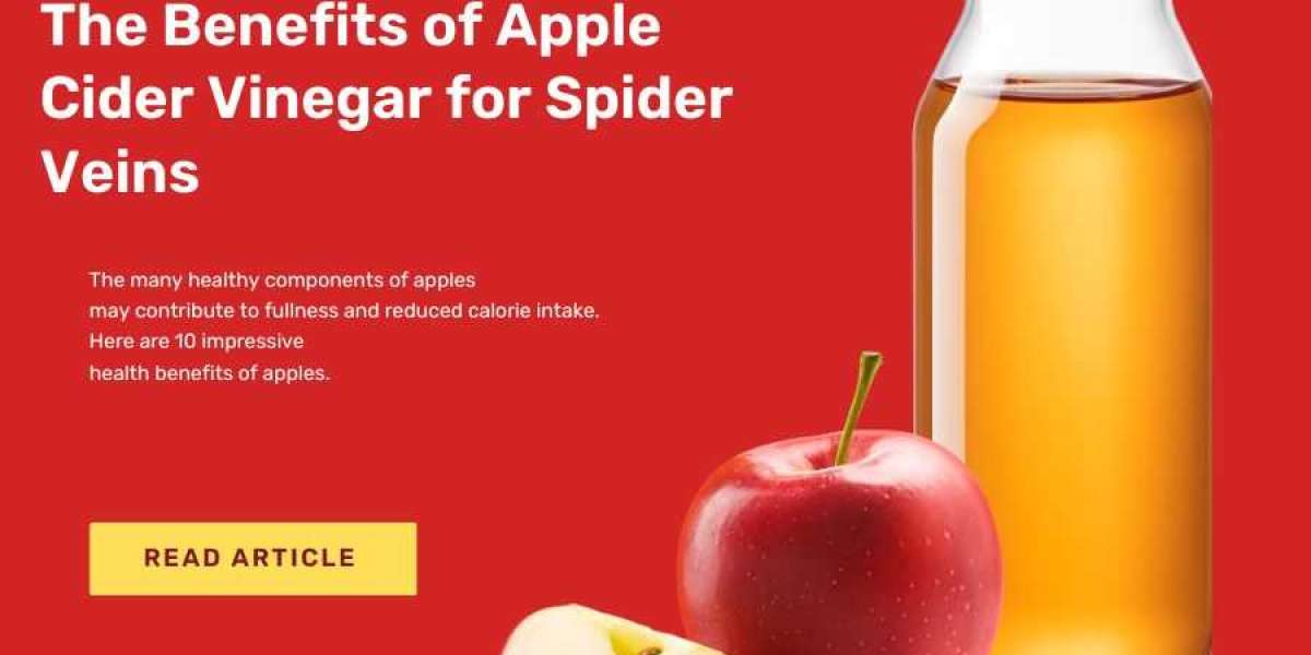 The Power of Apple Cider Vinegar in Treating Spider Veins