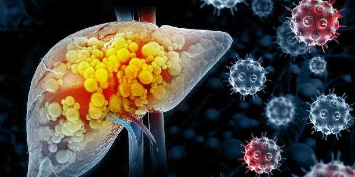 Liver Fibrosis Market Report (2024-2034): Epidemiology, Industry Trends, Share, Size, Demand