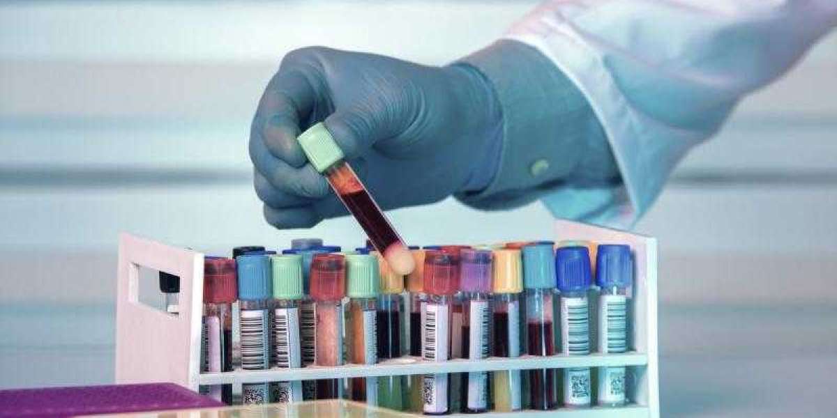Global Biobanking Market Size, Share, Growth, Revenue, Trends, Report 2024-2032
